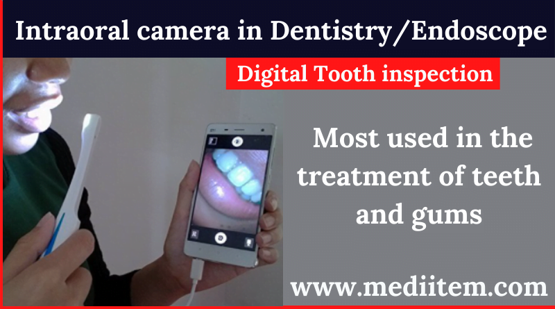 Intraoral camera in Dentistry