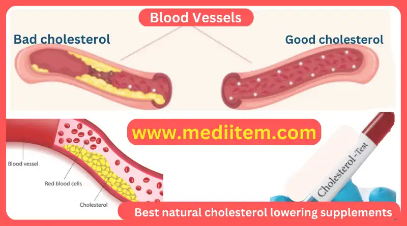 best natural cholesterol lowering supplements