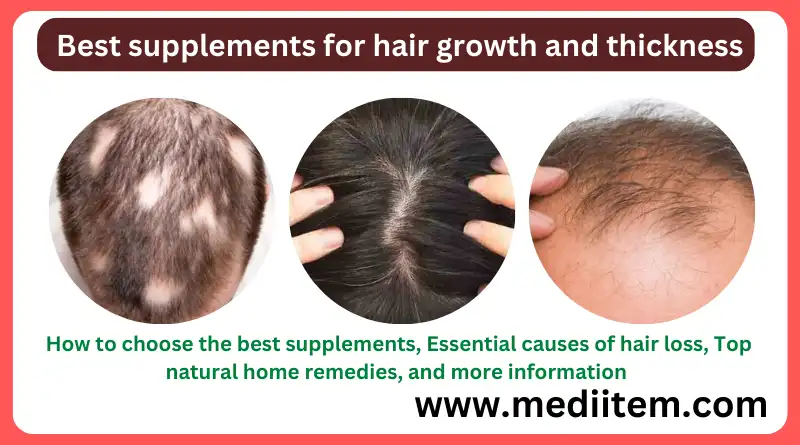 Top 11 essential supplements for hair growth and thickness