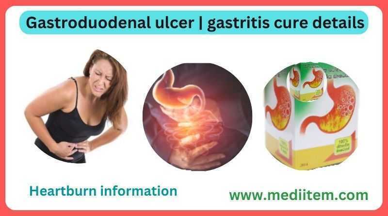 Gastroduodenal ulcer | gastritis cure details