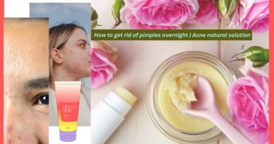 How to get rid of pimples overnight | Acne natural solution