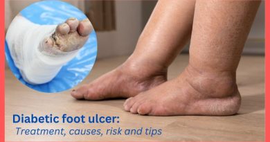 Diabetic foot ulcer treatment, causes, risk and tips