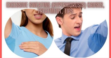 Excessive sweating (hyperhidrosis) causes, treatment, tips