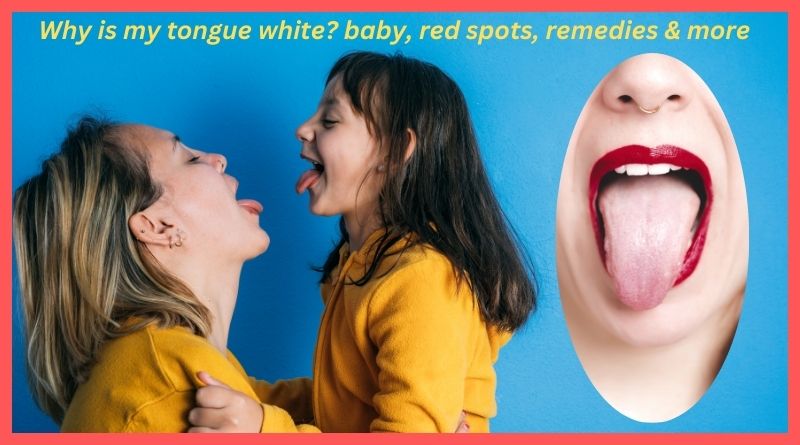 Why is my tongue white baby, red spots, remedies & more