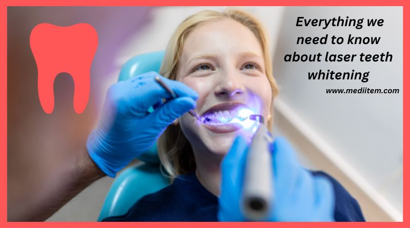 Everything we need to know about laser teeth whitening