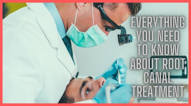 How long does a root canal take